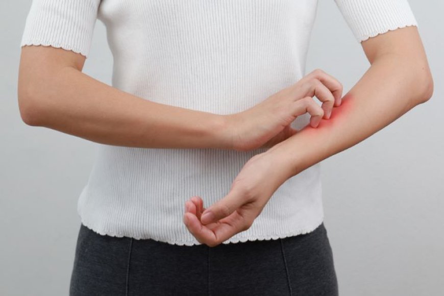  SOĞUK HAVA VE RÜZGAR EGZAMAYI TETİKLİYOR! 