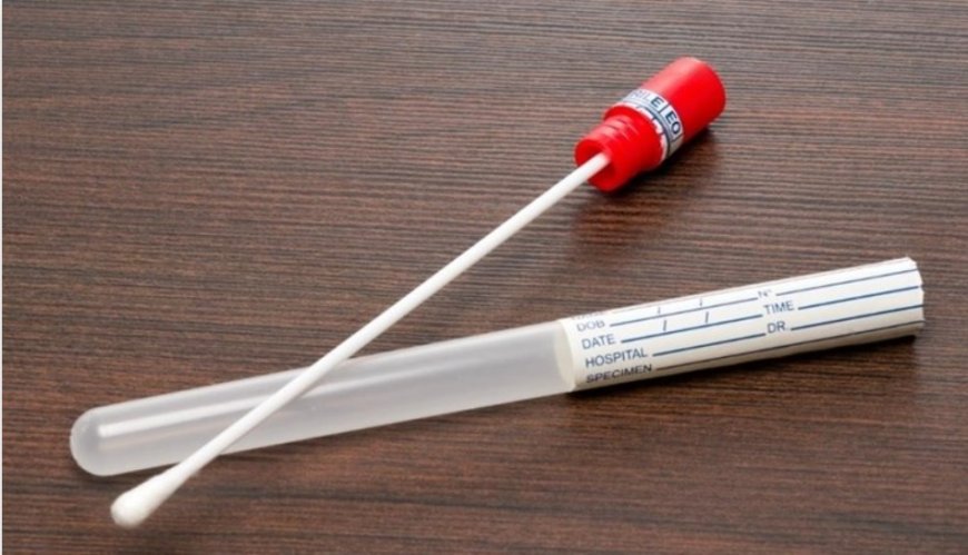 DNA sonuçlarında 'aile içi ilişki' patlaması! Oranlar korkuttu...