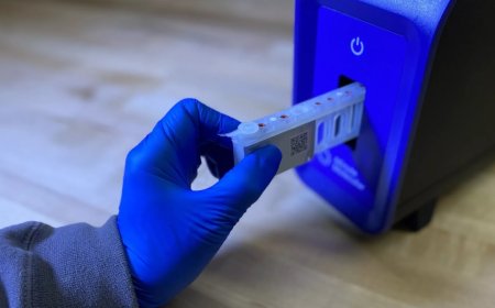 Daha Bulaşıcı Maymun Çiçeği Varyantı İsveç'te Tespit Edildi: Afrika Dışındaki İlk Vaka