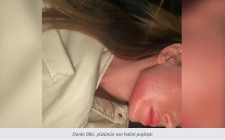 Danla Biliç, eski sevgilisi tarafından darp edildi:  Defalarca tehdit ve tacize uğradım