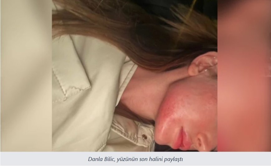 Danla Biliç, eski sevgilisi tarafından darp edildi:  Defalarca tehdit ve tacize uğradım