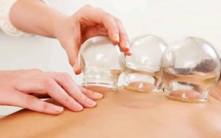 Hacamat: Binlerce Yıllık Yöntemin Bilim ve Modern Tıptaki Yeri