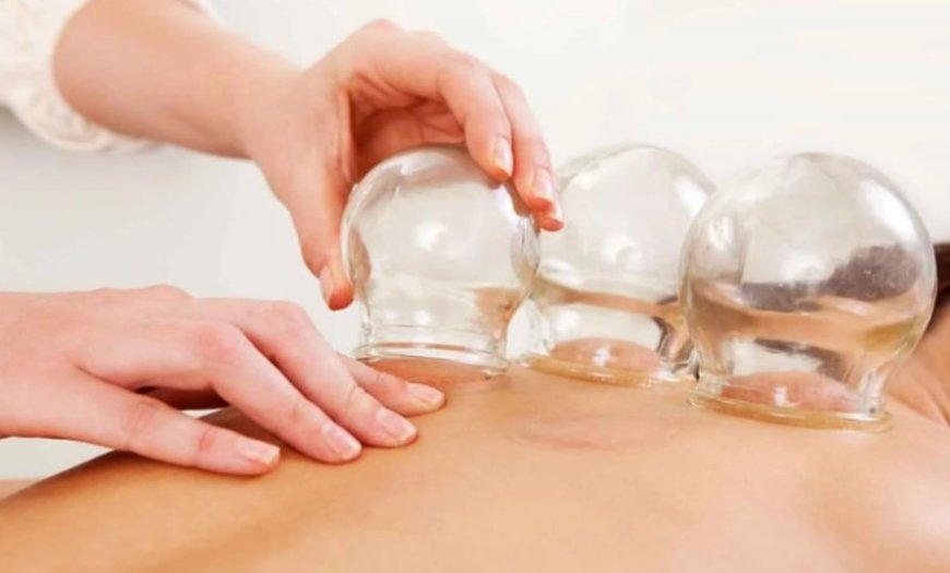 Hacamat: Binlerce Yıllık Yöntemin Bilim ve Modern Tıptaki Yeri